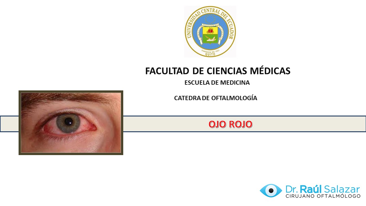Diapositiva1