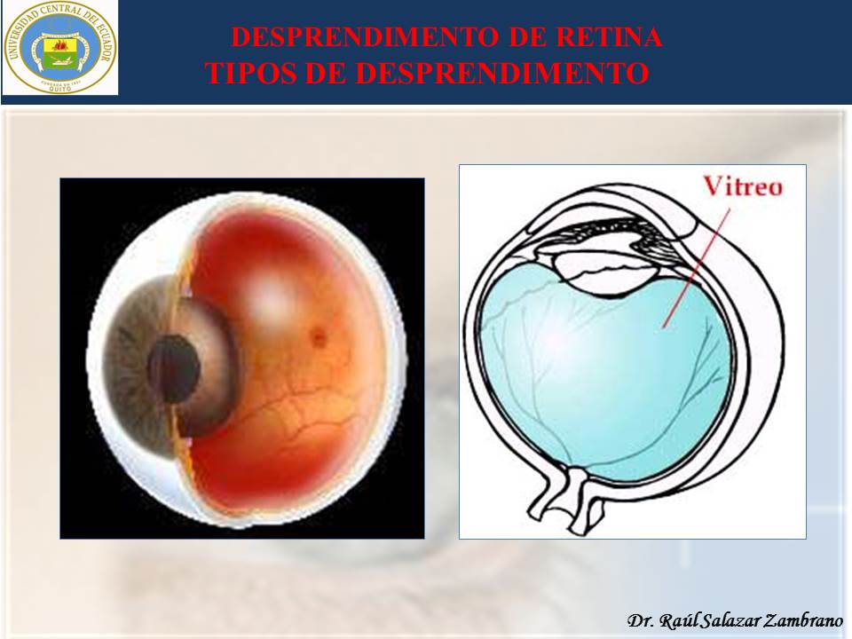 Diapositiva10-2