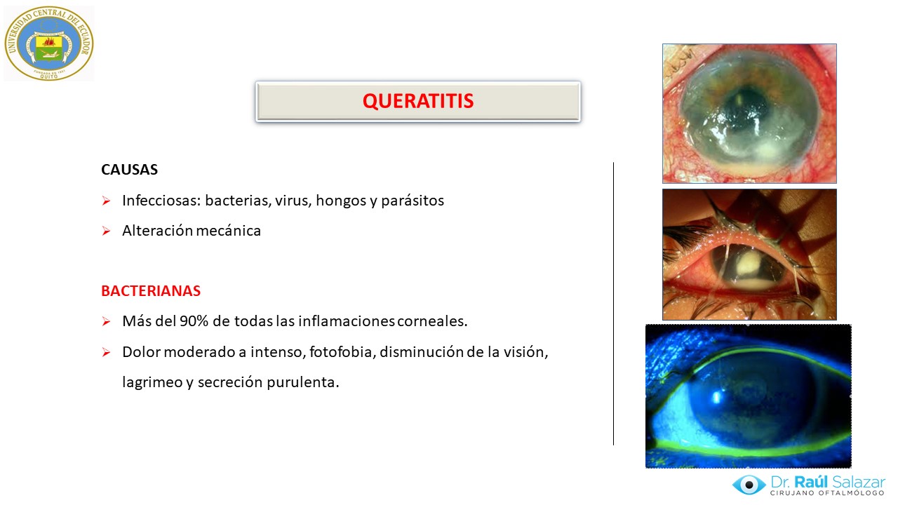 Diapositiva101