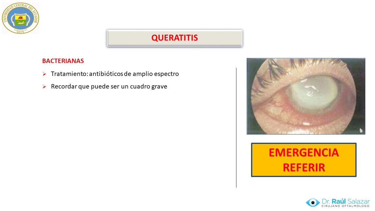 Diapositiva102