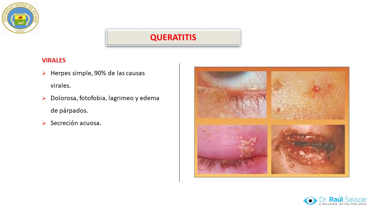 Diapositiva103