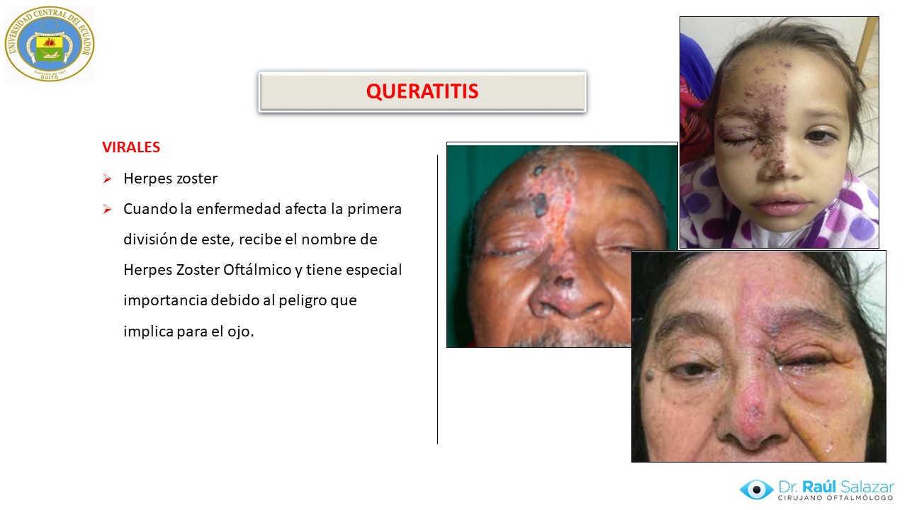 Diapositiva104