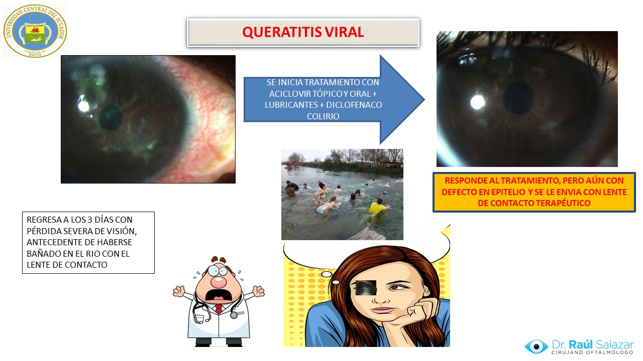 Diapositiva108