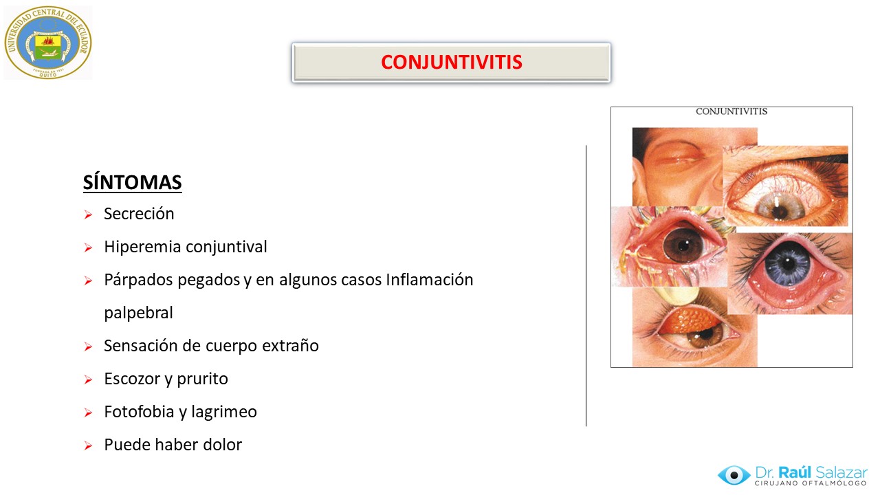 Diapositiva11