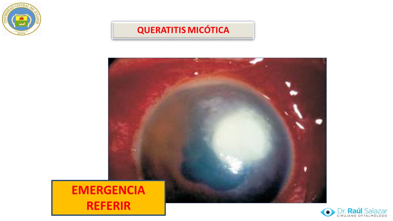 Diapositiva110
