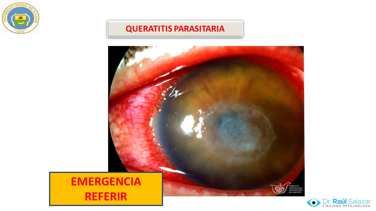 Diapositiva111