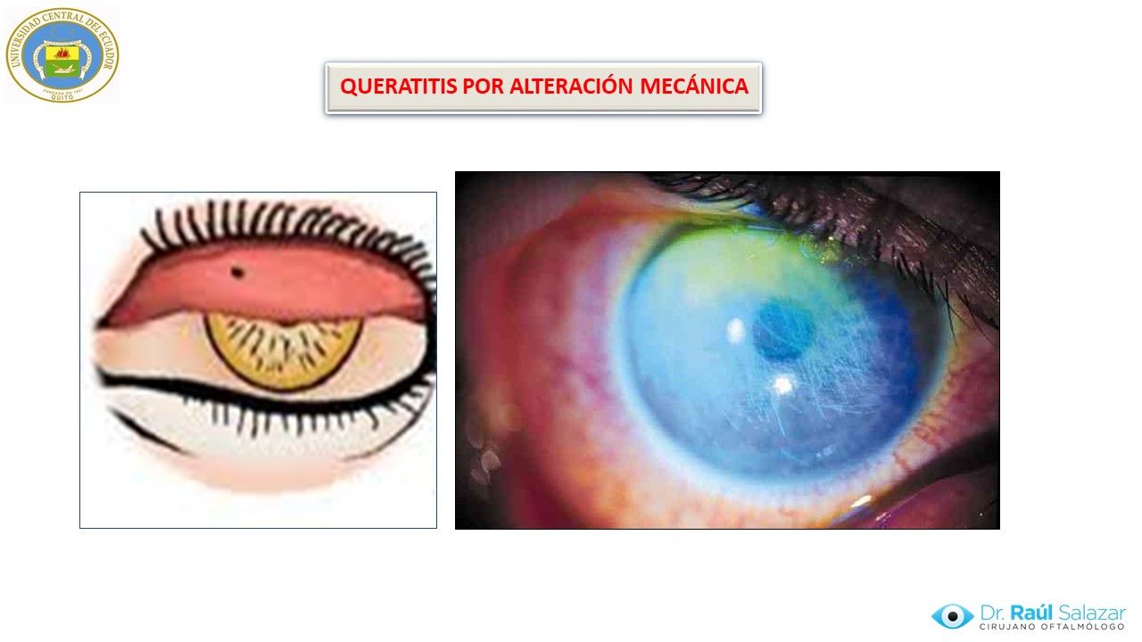 Diapositiva114