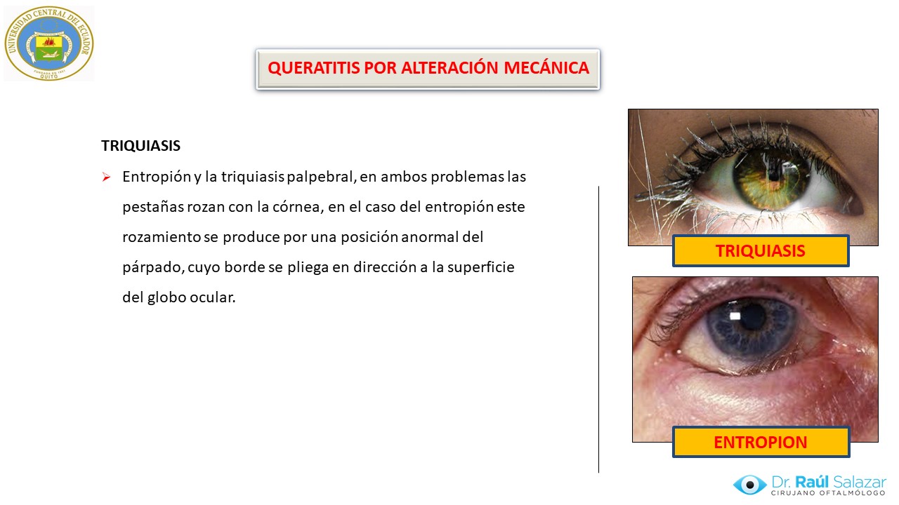 Diapositiva116