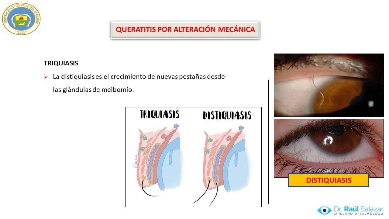 Diapositiva117