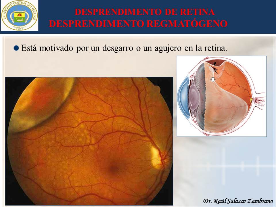 Diapositiva12-3