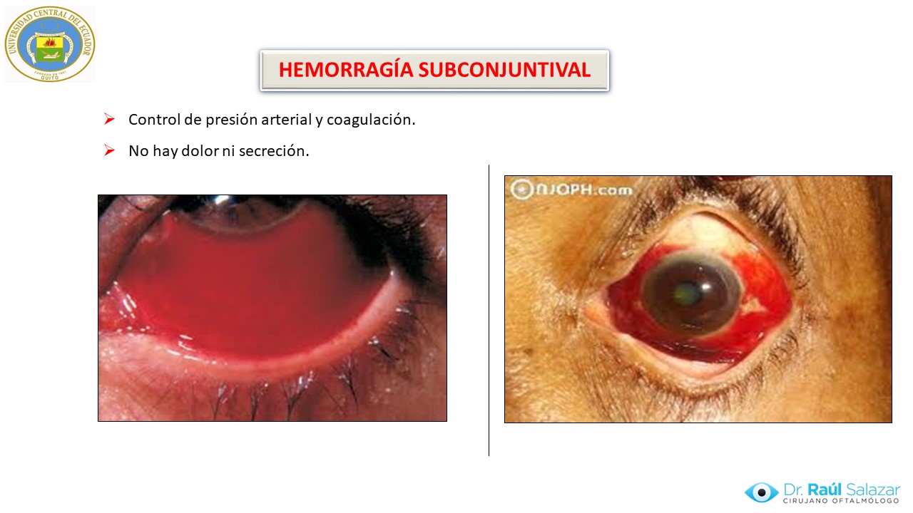 Diapositiva121