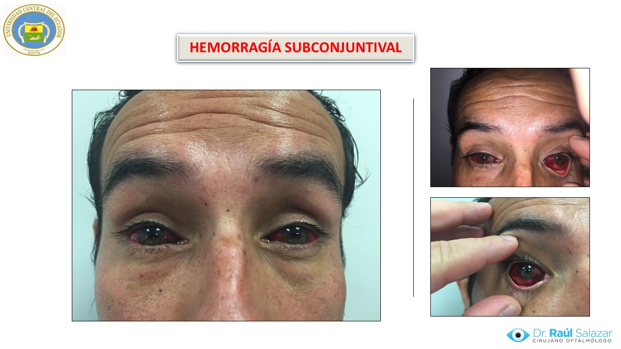 Diapositiva123