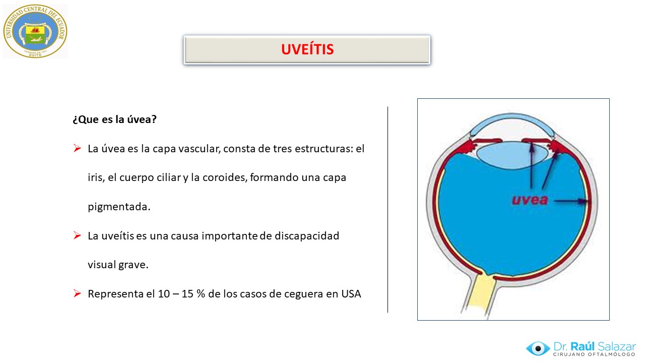 Diapositiva126
