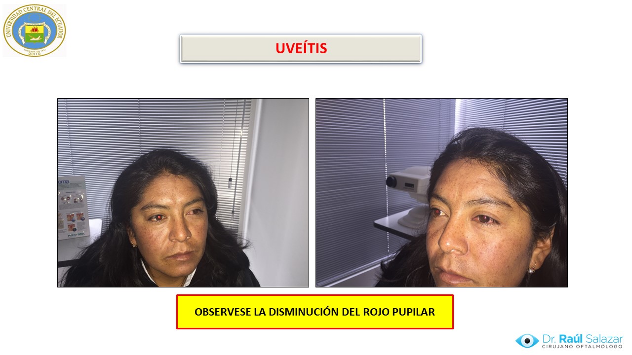 Diapositiva130