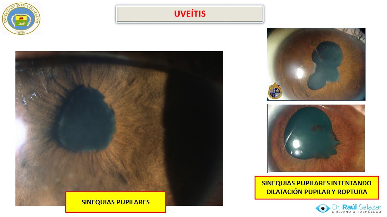 Diapositiva135