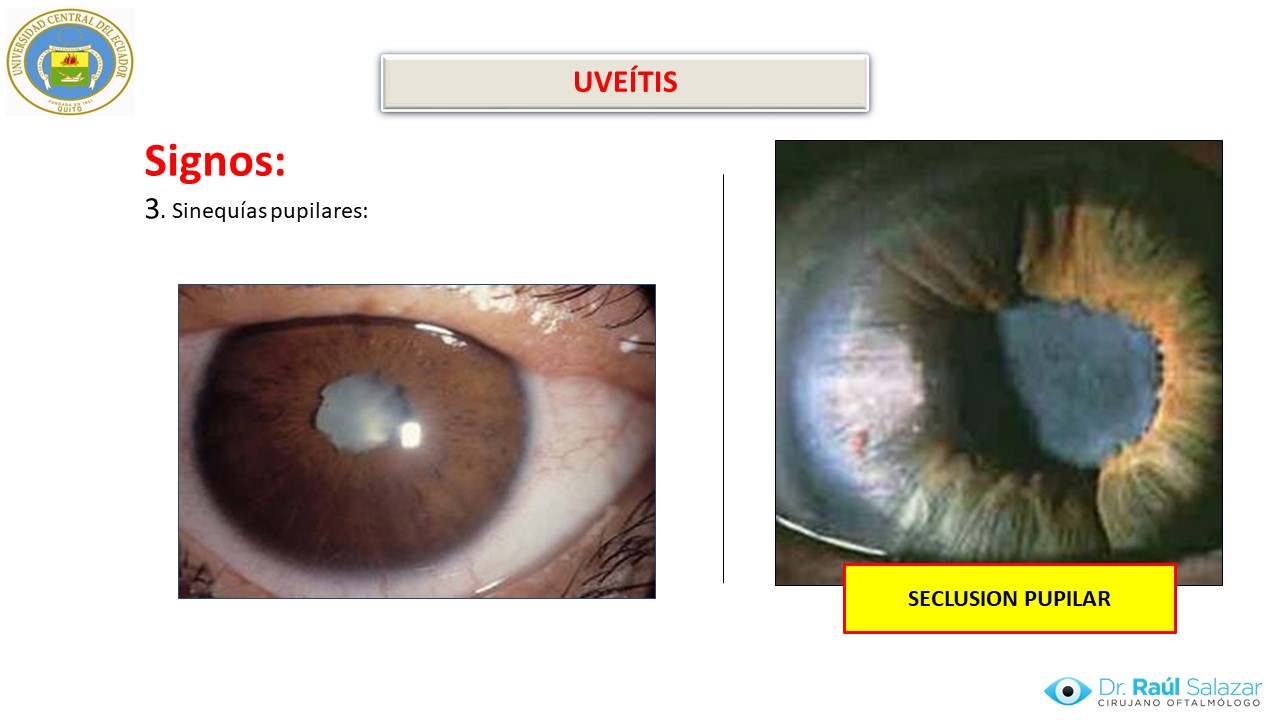 Diapositiva136