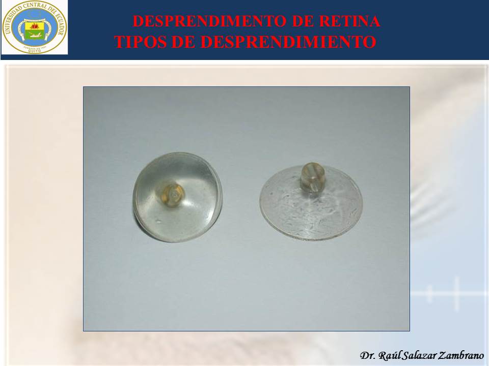 Diapositiva14-3