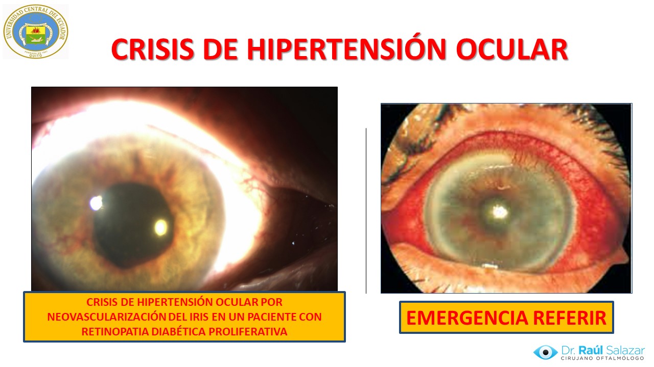 Diapositiva141