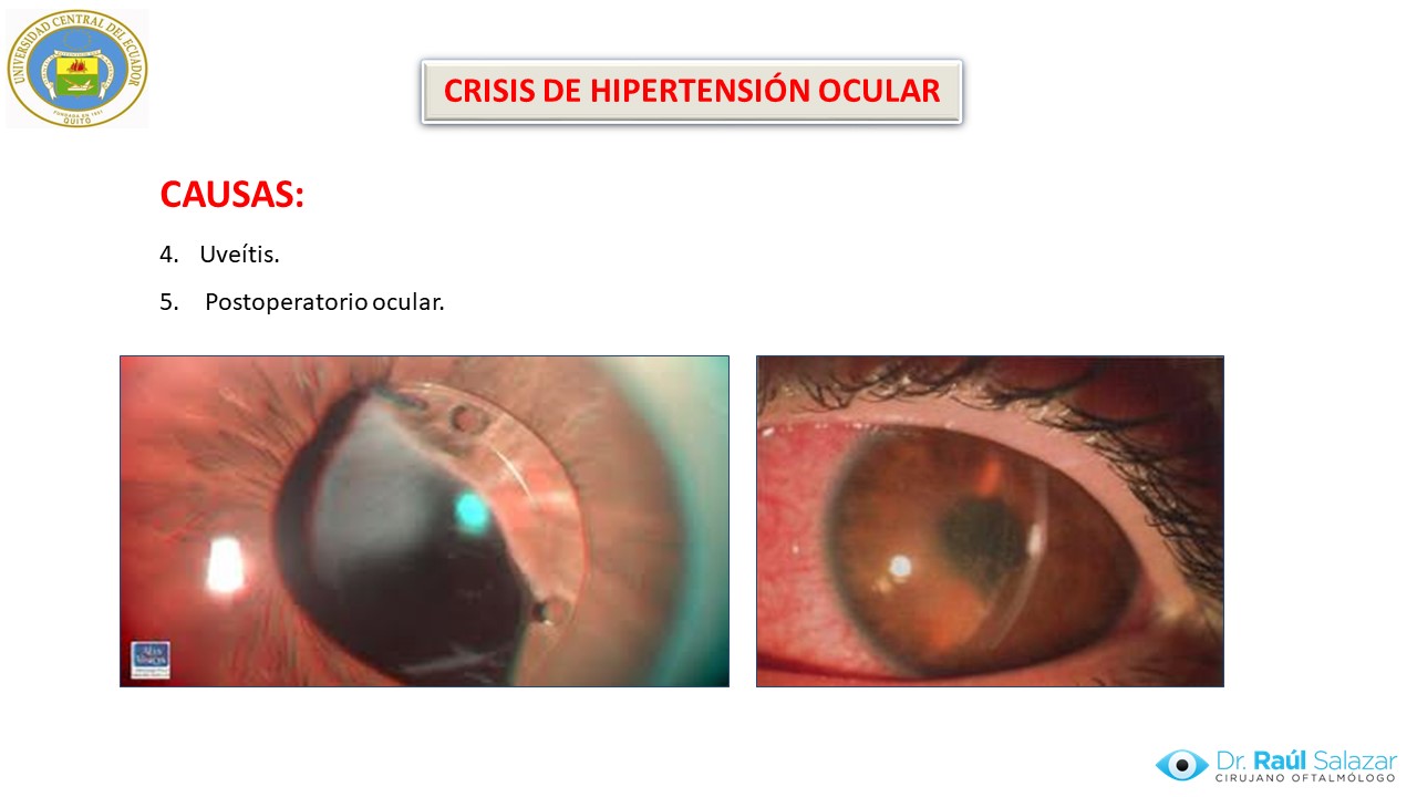 Diapositiva143