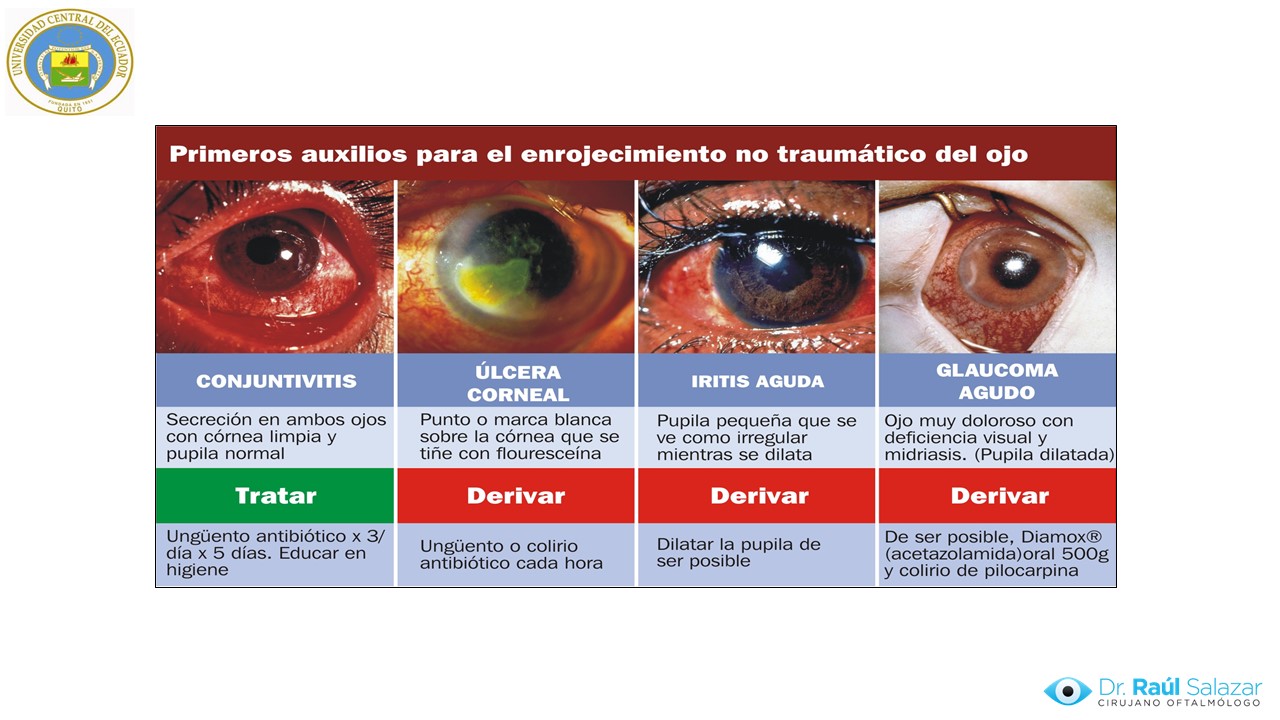 Diapositiva149
