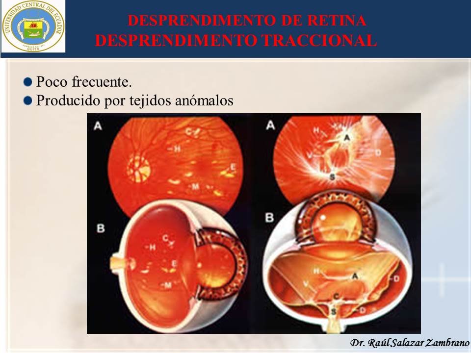 Diapositiva15-3