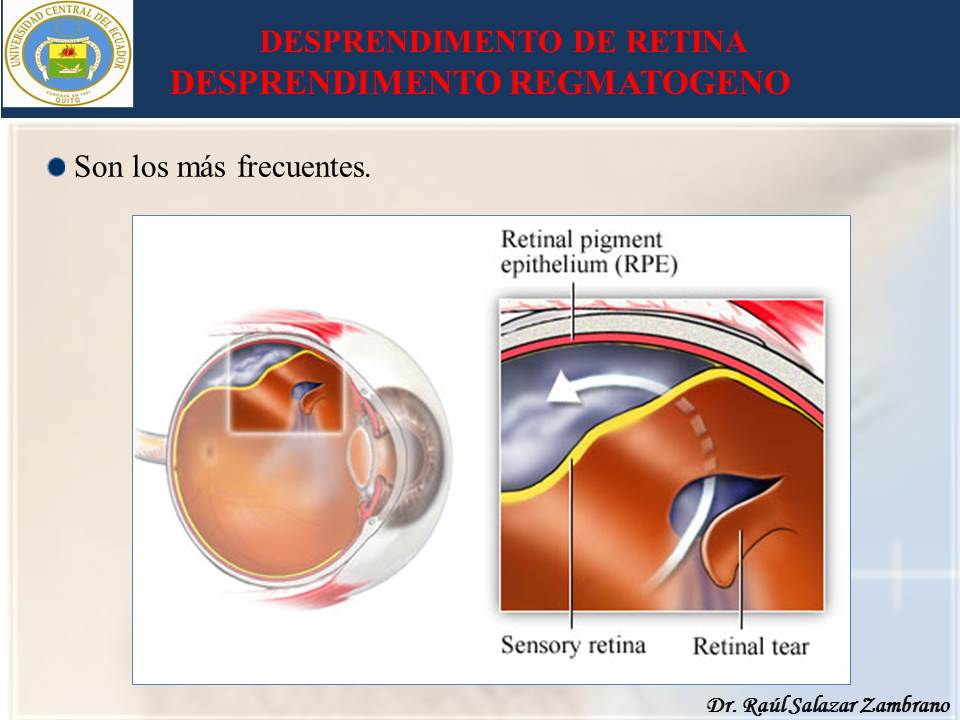 Diapositiva17-2