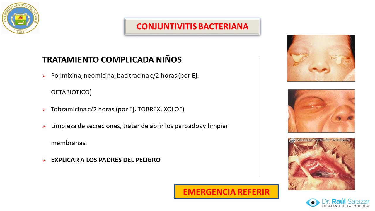 Diapositiva18