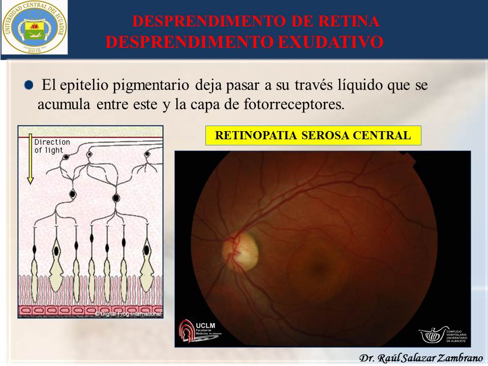Diapositiva19-2