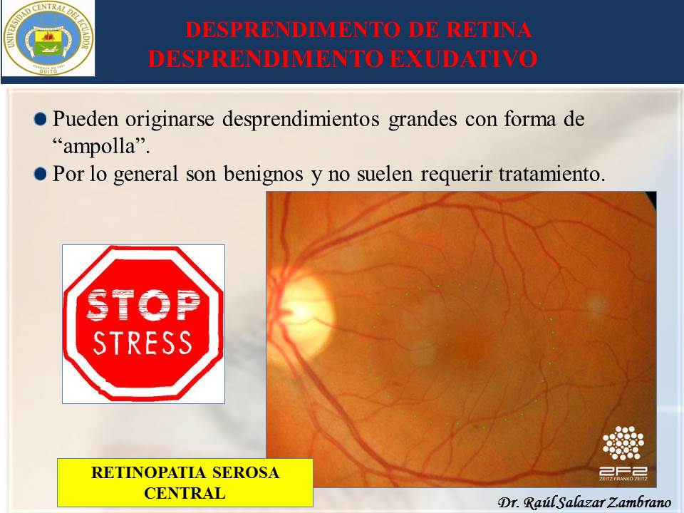 Diapositiva21-2