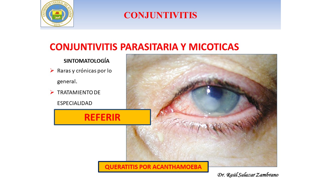 Diapositiva22