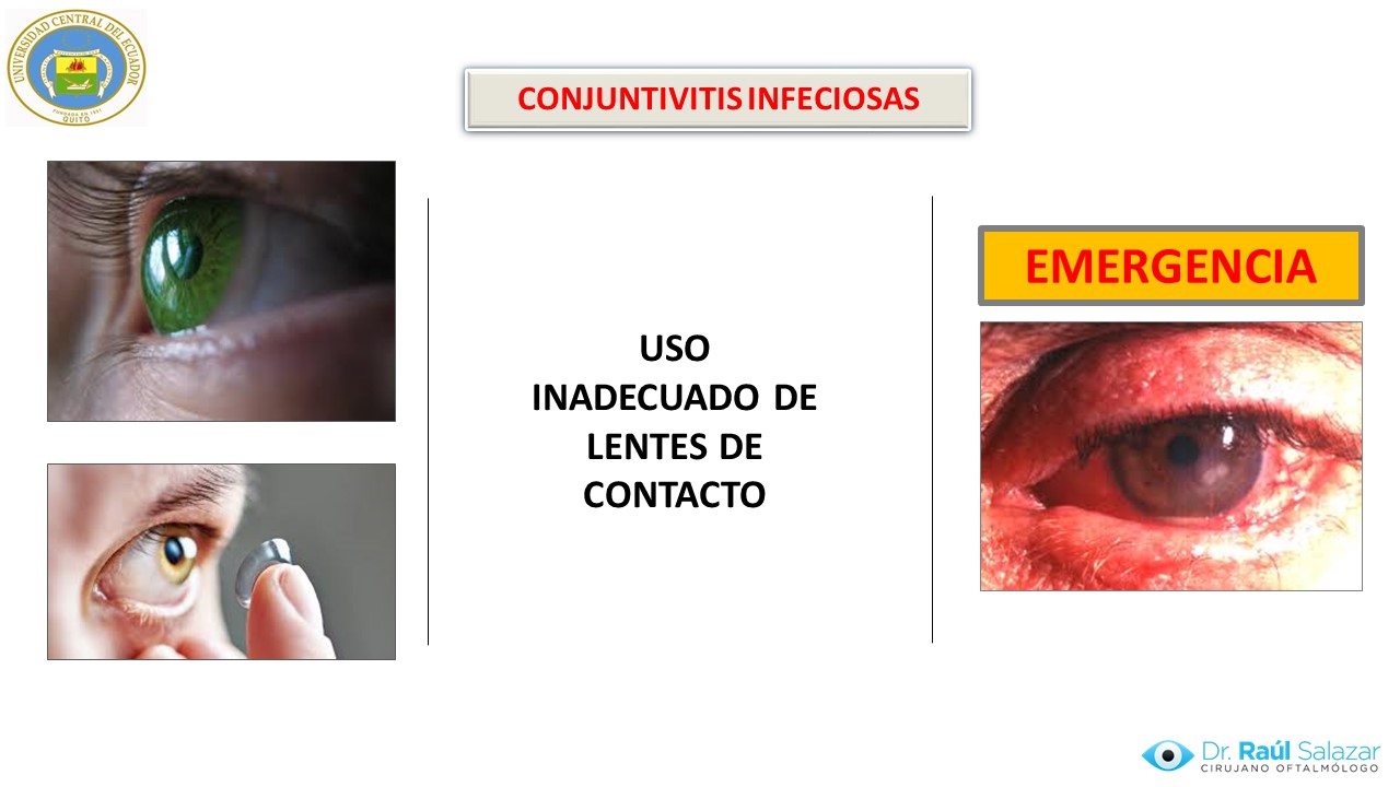 Diapositiva23
