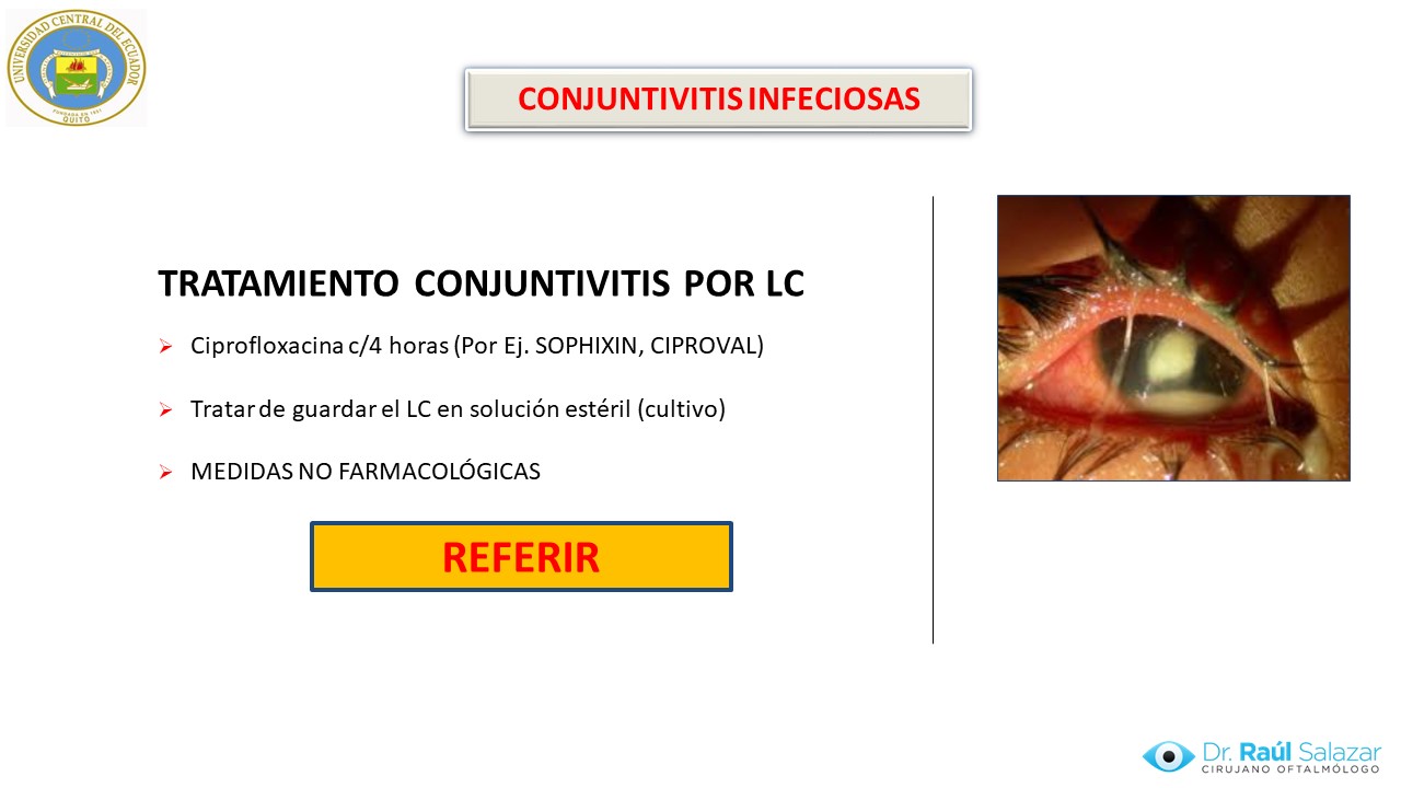 Diapositiva24