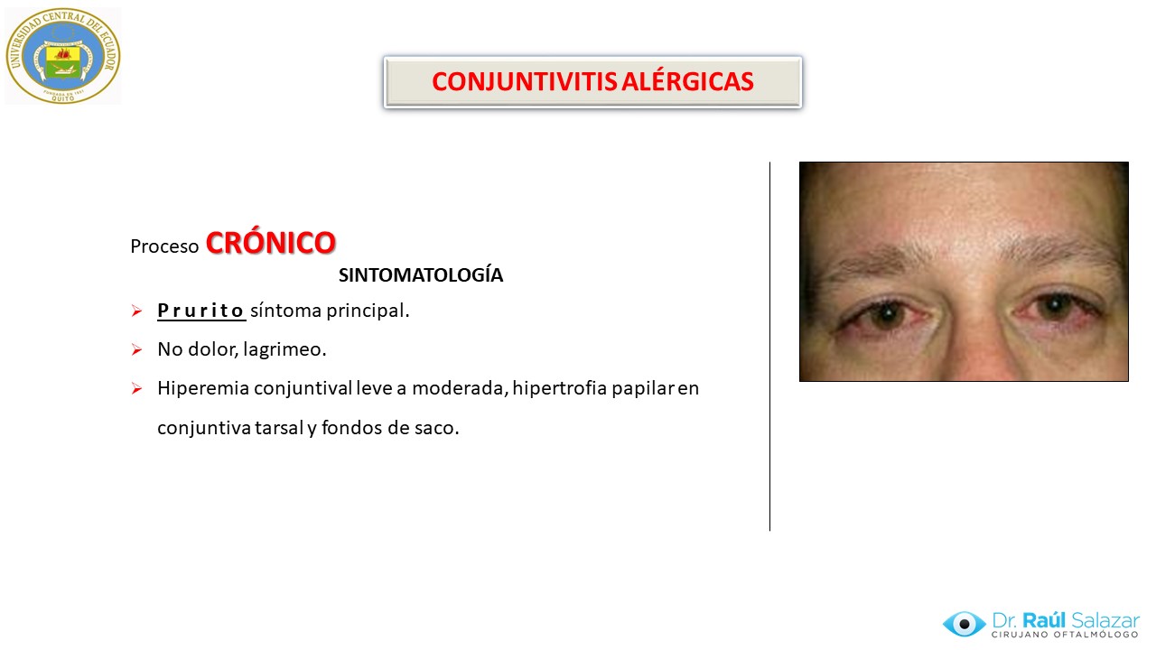 Diapositiva26