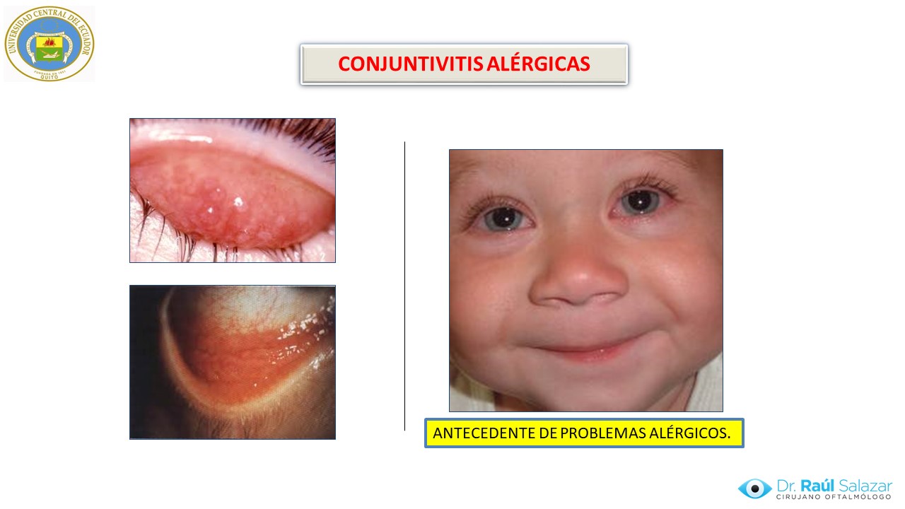 Diapositiva27
