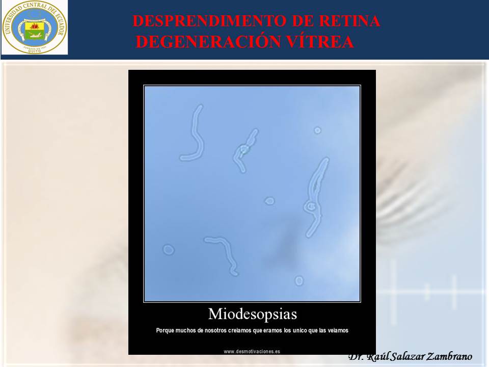 Diapositiva28-1