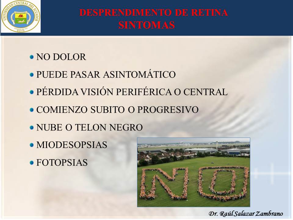 Diapositiva32-1