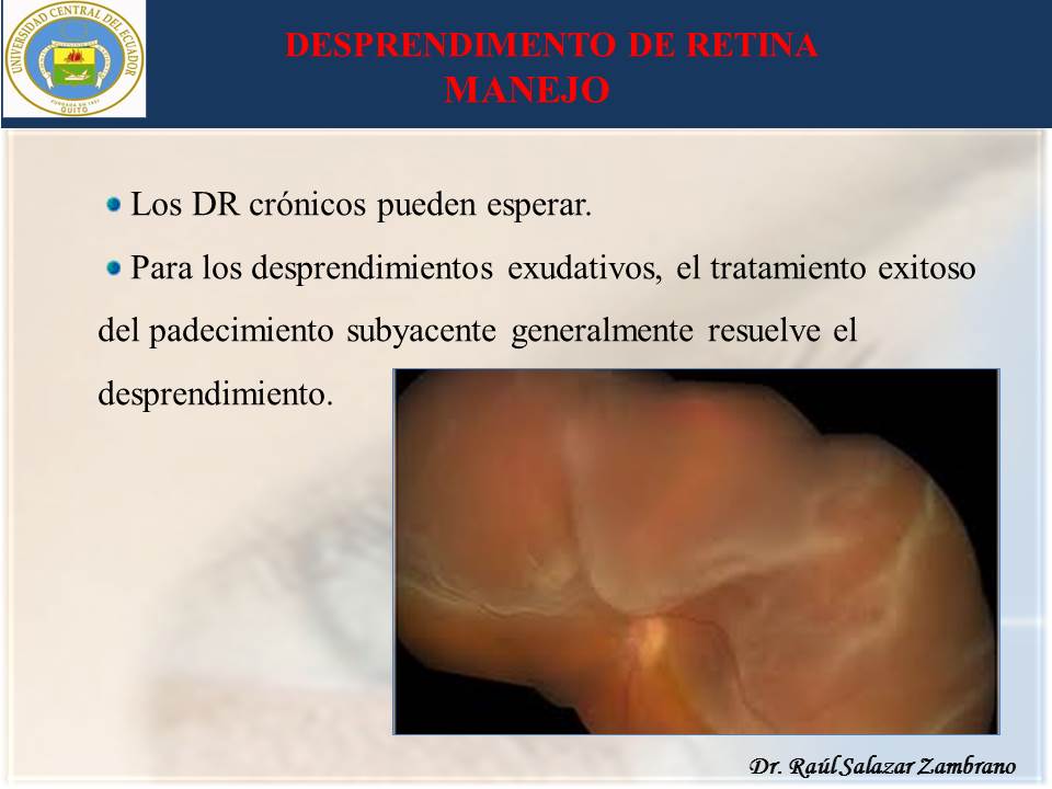 Diapositiva35-2