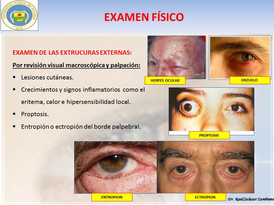 Diapositiva36-3