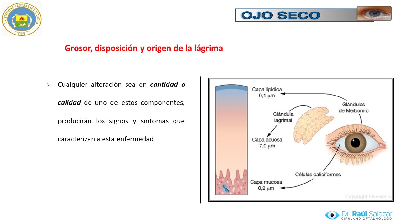 Diapositiva37