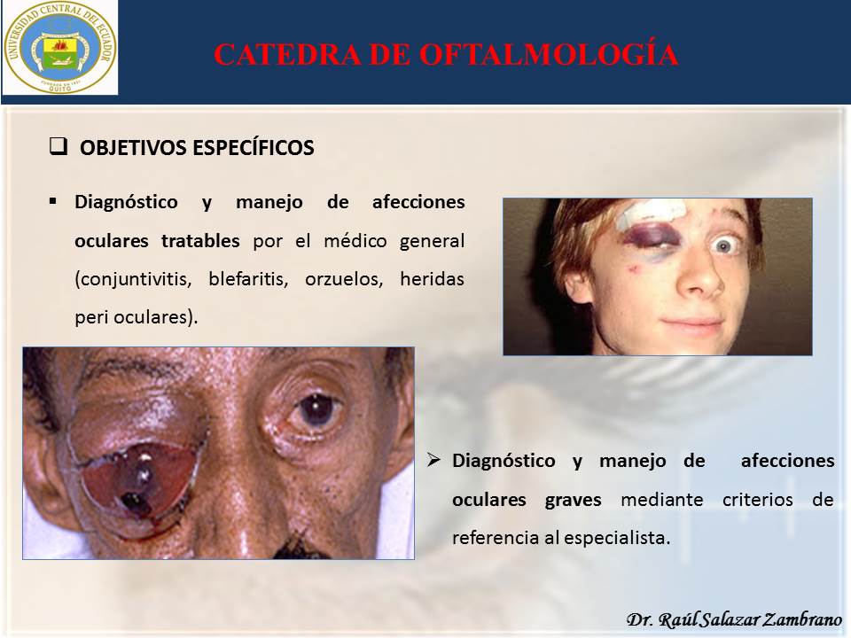 Diapositiva4-4