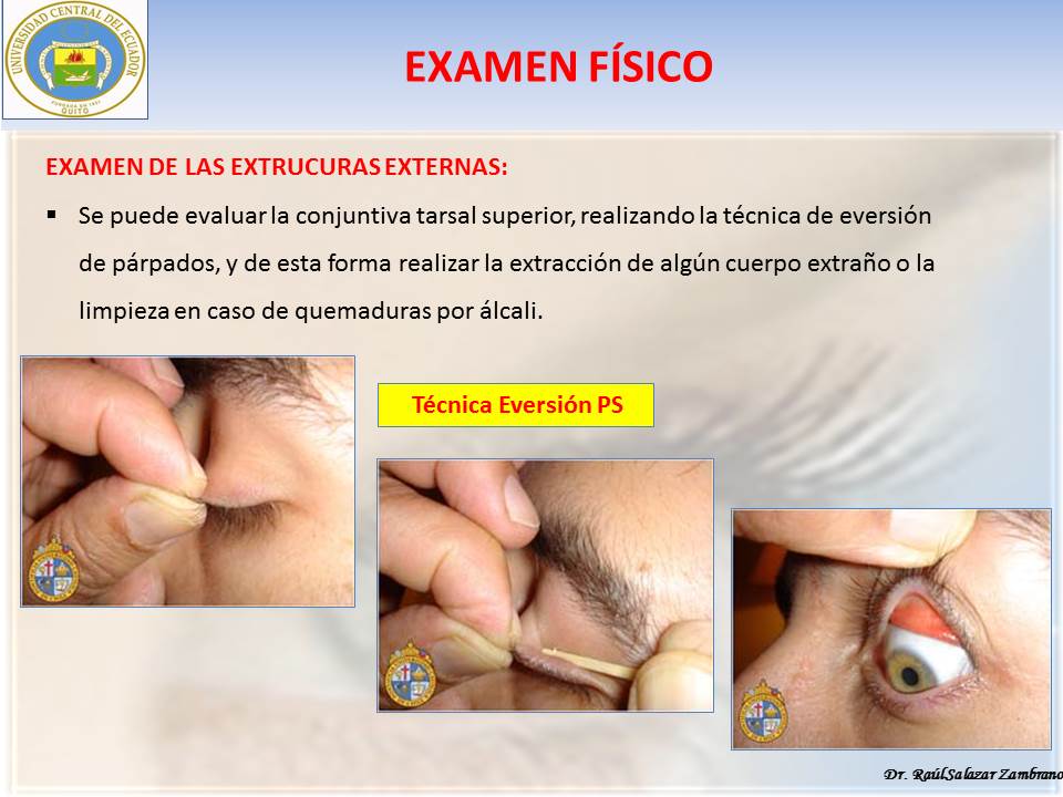 Diapositiva40-3