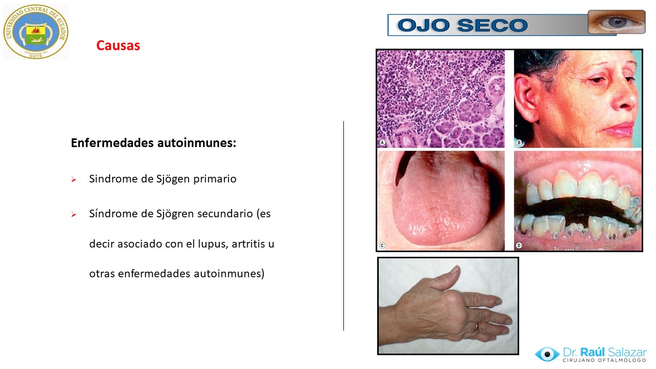 Diapositiva41