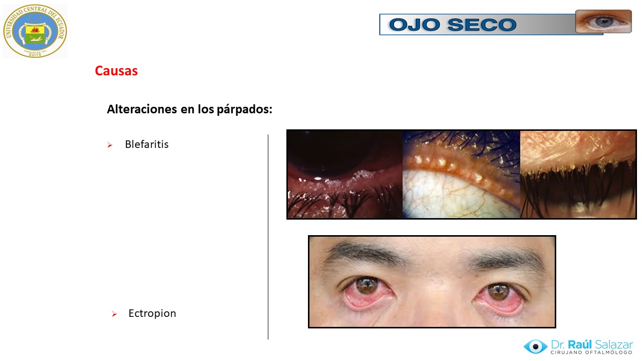 Diapositiva43