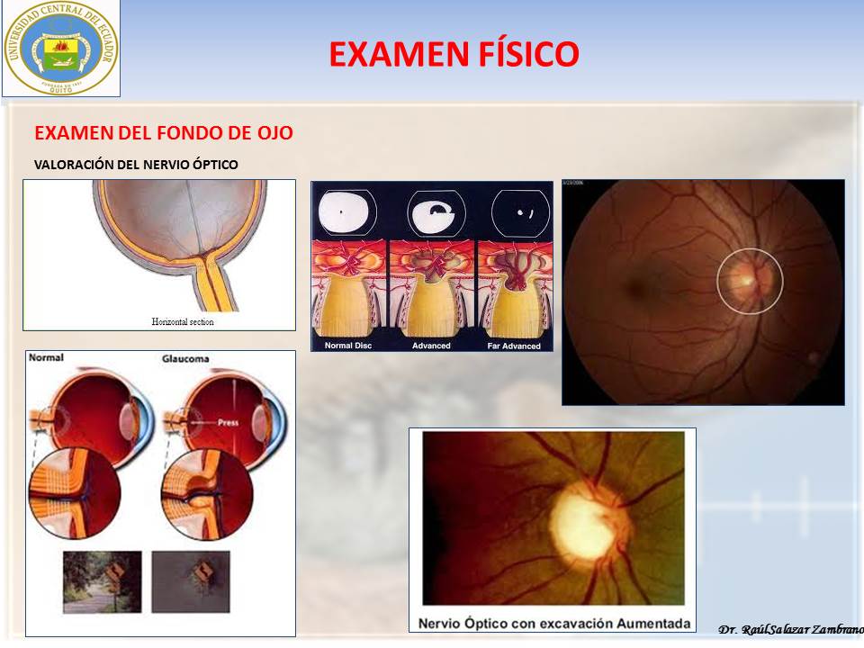 Diapositiva46-3