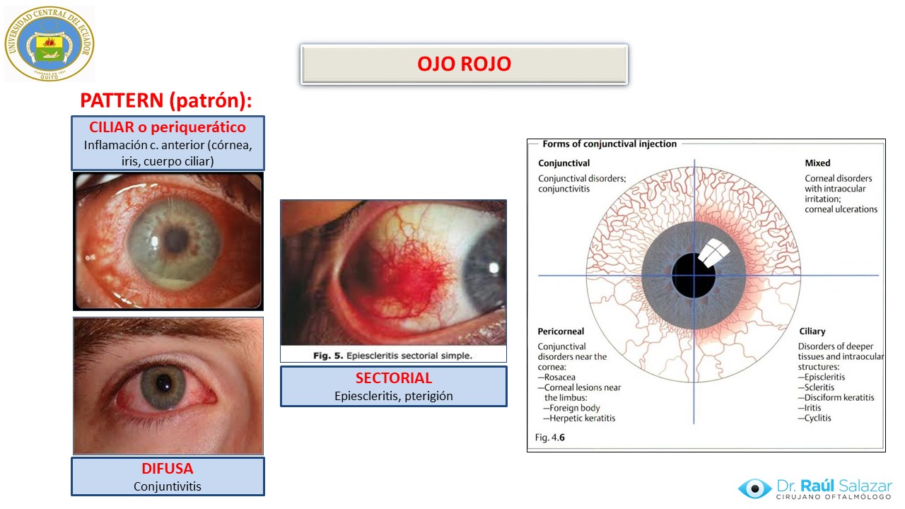 Diapositiva5