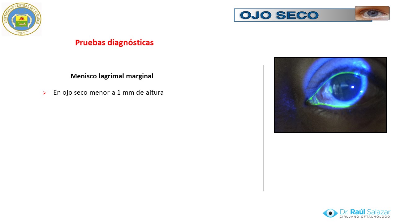 Diapositiva51