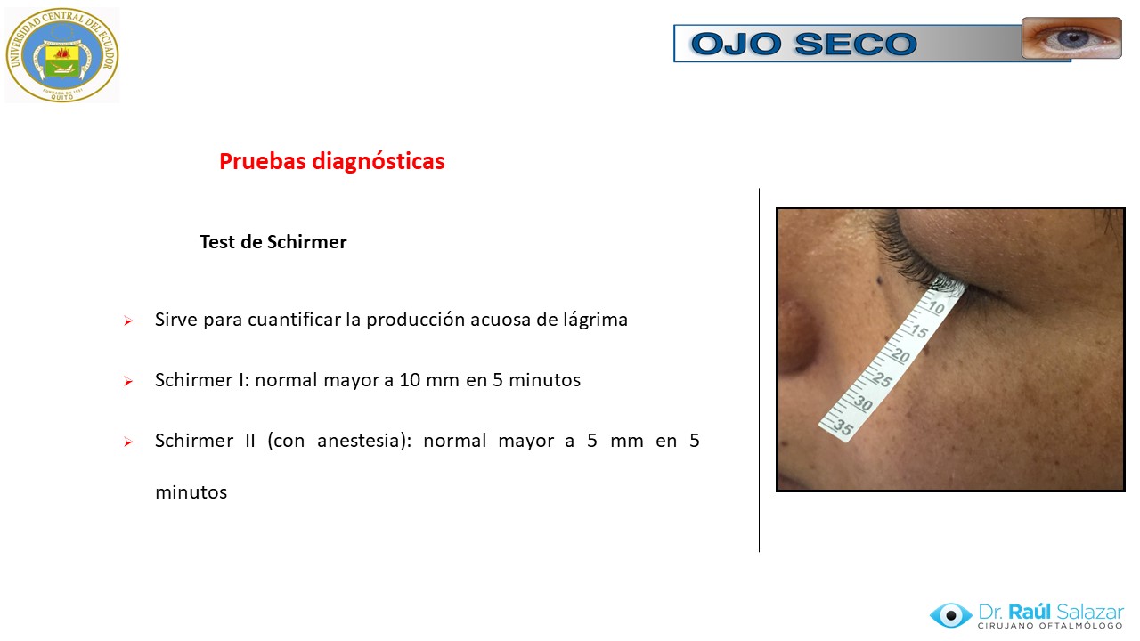 Diapositiva52