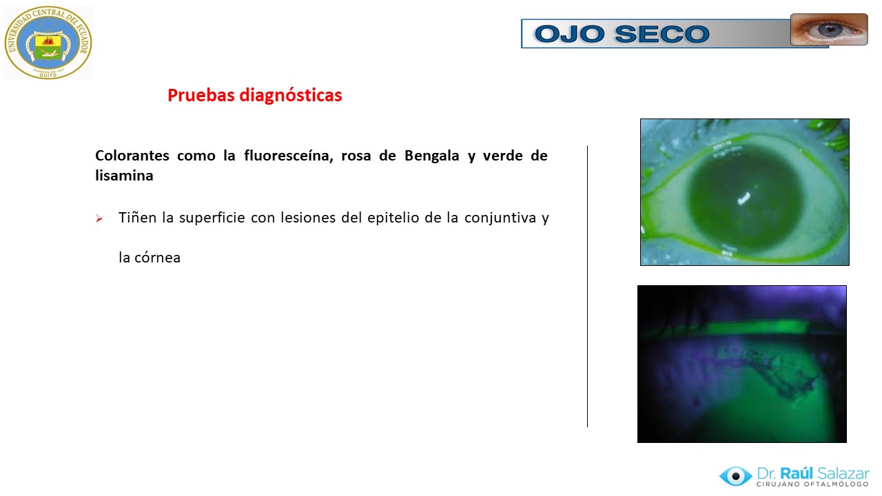 Diapositiva53
