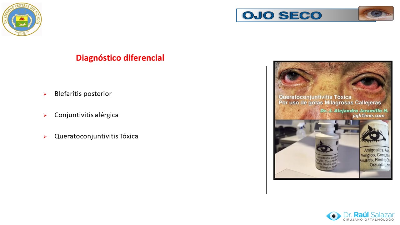 Diapositiva54