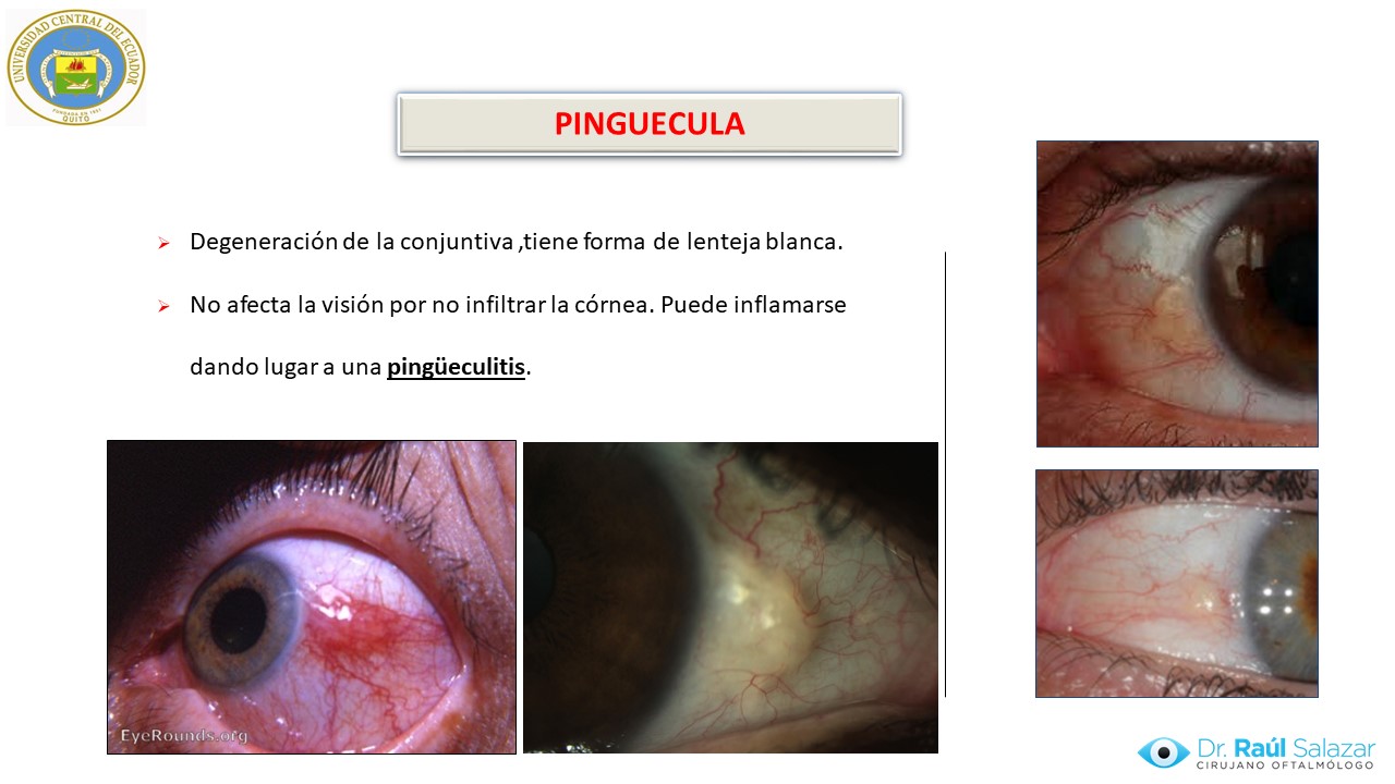 Diapositiva61